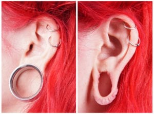 ear lobe repair, brunswick nj